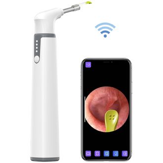 Teslong Smart Otoscope Wi-Fi otoskop na kontrolu a čistenie uší