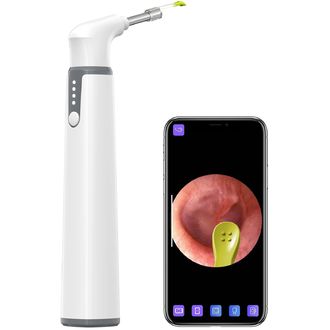 Teslong Smart Otoscope Wi-Fi otoskop na kontrolu a čistenie uší